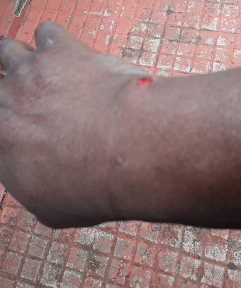 PM de folga fica ferido após ajudar colegas em ocorrência